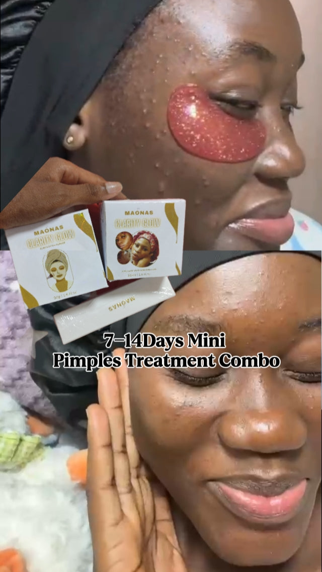 Maonas Mini Pimples Treatment Combo
